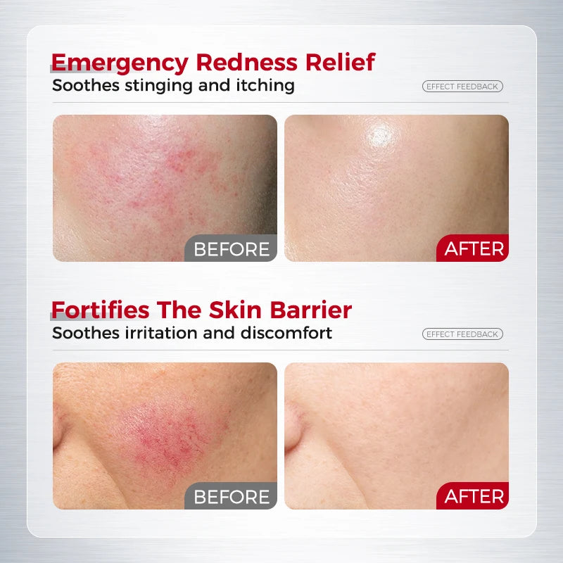 Hydrating Soothing Essence Cream – Collagen, Ceramides, Hyaluronic Acid & Plant Extracts