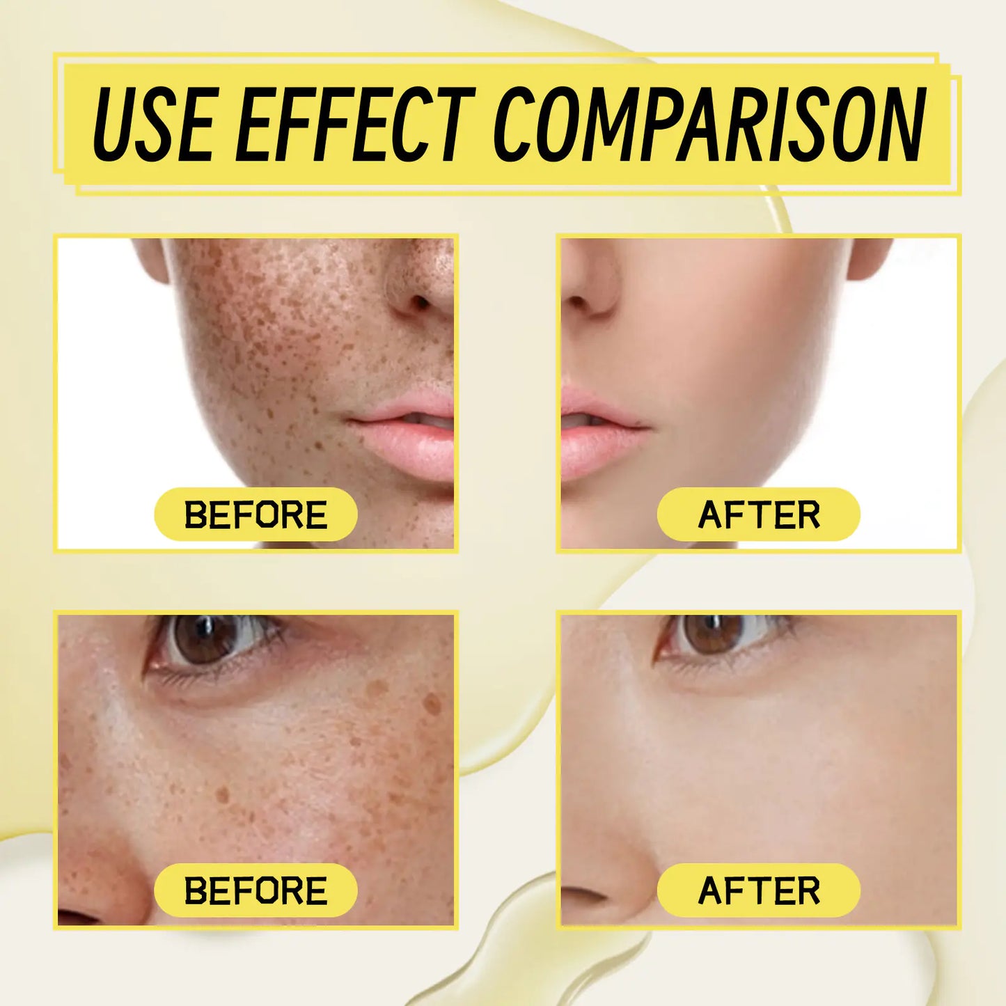OUHOE Dark Spot Correction Serum for Brightening Skin